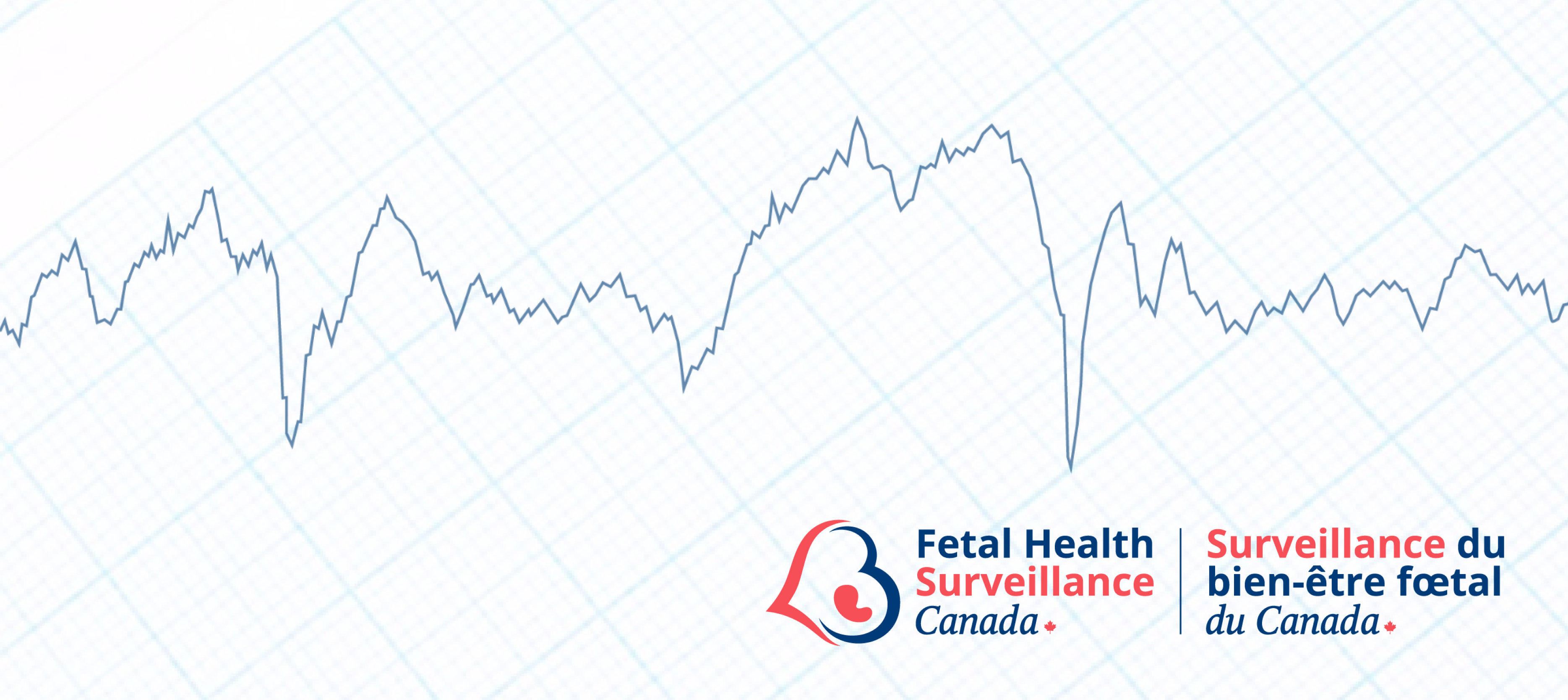 Course Image {mlang en} FHS Canada Fundamentals of Fetal Health Surveillance Online Manual{mlang}{mlang fr_ca}Manuel en ligne sur les principes fondamentaux de la surveillance du bien-être fœtal de SBF Canada{mlang}